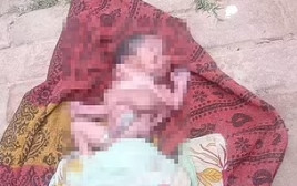 תינוק בהודו נולד עם שמונה גפיים ושתי פנים (צילום: רשתות חברתיות, שימוש לפי סעיף 27 א')