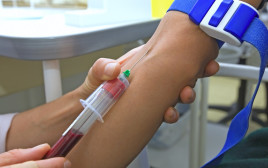 בדיקת דם ל-HIV. לאחר מגע מיני מזדמן לא מוגן  (צילום: שאטרסטוק)