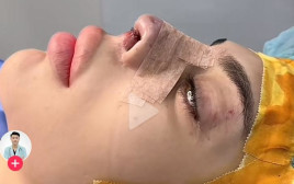 רומי אברג'יל בחדר הניתוח (צילום: מתוך טיקטוק)