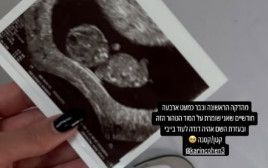 הסטורי של קארין כהן (צילום: מתוך אינסטגרם)