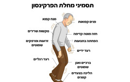 תסמיני מחלת הפרקינסון. רעד ונוקשות (צילום: שאטרסטוק)