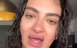 פרידה עוזיאל על הפפילומה  (צילום: יחסי ציבור)