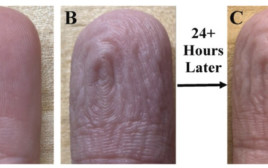 השינויים בקמטוטי האצבעות (צילום: Behav Biomed Mater)