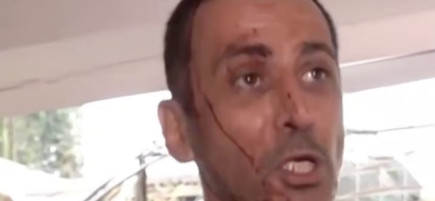 תושב רחובות ניצל מפגיעת טיל בזכות קקי (צילום: צילום מסך רשת 13)