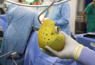 השתלת לב אנושי (צילום: יחידת הצילום, שיבא)