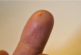 השתל הביוני (צילום:  בי"ח מורפילדס)