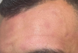 שופט שהותקף לאחר המשחק בני סכנין – מכבי חיפה (צילום: באדיבות המצולמים, .)