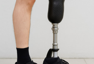 הסוד מאחורי כריתת הרגל  (צילום: מעריב אונליין)