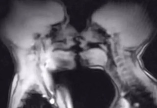 יחסי מין בתוך מכשיר MRI (צילום: צילום מסך)