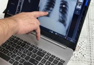 שירות צילומי רנטגן בבית  (צילום: דוברות כללית)