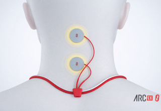 ARC-EX. גירוי עצבי מתקדם (צילום: איור: arc-ex)