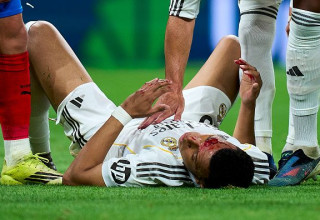 קיליאן אמבפה מדמם על הדשא (צילום: Getty images)