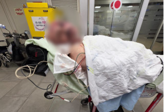בוריס קוניק. הותקף באכזריות  (צילום: אדוארד קוניק)