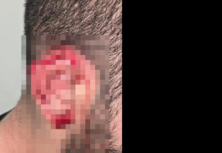 הקטין שהותקף בתא המעצר ברמלה (צילום: דוברות המשטרה)