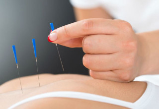 דיקור סיני  (צילום: Bigstockphoto)