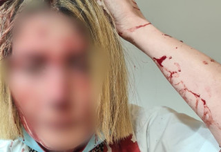 הרופאה שהותקפה בבאר יעקב  (צילום: ללא קרדיט)