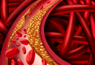 כולסטרול  (צילום: Shutterstock)