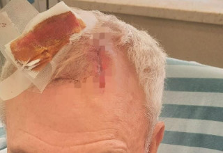 בן ה-73 שהותקף בבקבוק זכוכית על ידי רוכב אופנוע (צילום:  דוברות המשטרה)