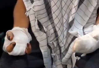 אחד הנפגעים במבצע הביפרים (צילום: רשתות ערביות)