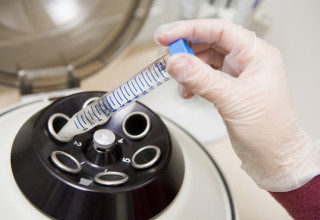 הפריה חוץ גופית. זרעונים זרים הפרו את הביצית (צילום: שאטרסטוק)