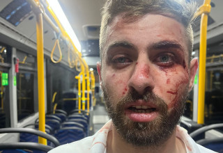 נהג אוטובוס שהותקף בירושלים (צילום: ארגון נהגי האוטובוסים בישראל)