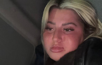 שלקה (צילום: אינסטגרם)