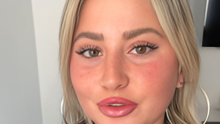 שלקה (צילום: צילום מסך מתוך אינסטגרם)