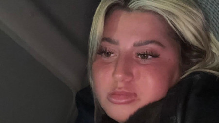 שלקה (צילום: אינסטגרם)