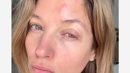 הסטורי של עדי הימלבלוי (צילום: מתוך אינסטגרם)