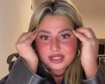 שלקה (צילום: אינסטגרם)