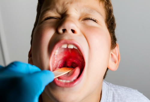 משטח גרון. עליה משמעותית במקרי ההתפשטות (צילום: שאטרסטוק)