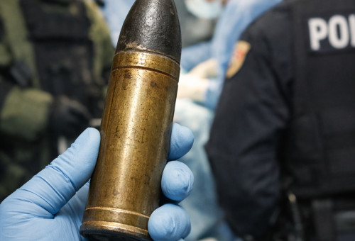 קליע מימי מלחמת העולם הראשונה במיון (צילום: AI)