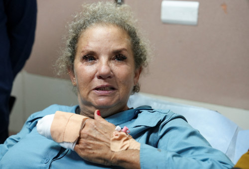 הצלמת היידי לוין לאחר שהותקפה על ידי מתנחלים (צילום: רויטרס)