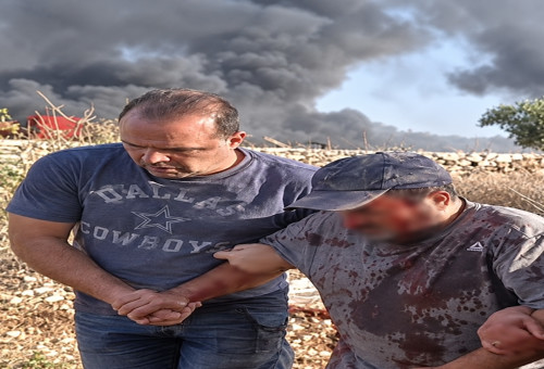 תיעוד מהעימות ביהודה ושומרון (צילום: רשתות חברתיות, שימוש לפי סעיף 27 א')