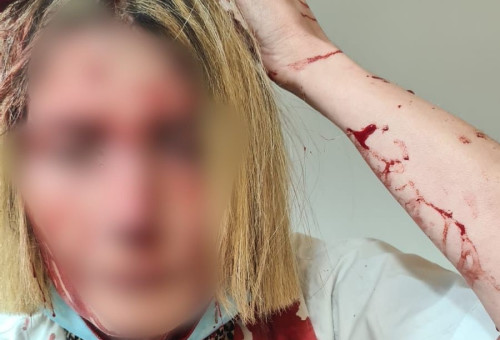 הרופאה שהותקפה בבאר יעקב  (צילום: ללא קרדיט)