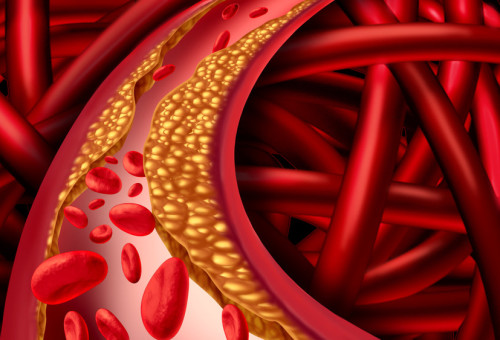 כולסטרול  (צילום: Shutterstock)