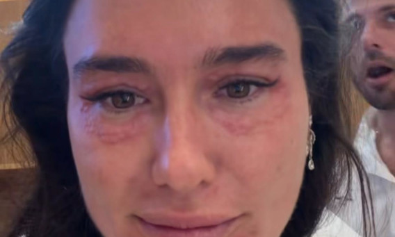 הסטורי של אדל בספלוב (צילום: אינסטגרם)