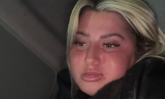 שלקה (צילום: אינסטגרם)