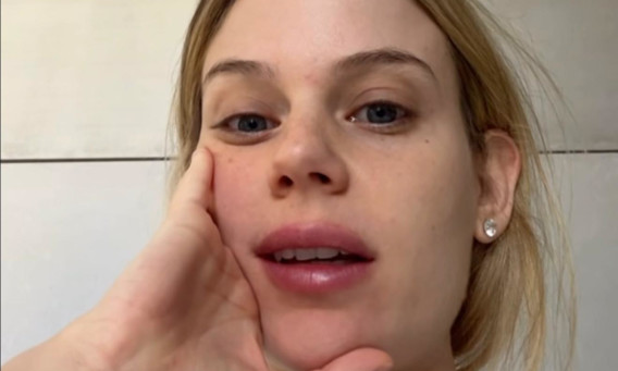 הסטורי של בר זומר (צילום: אינסטגרם)