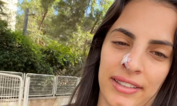 לינוי אשרם (צילום: מתוך אינסטגרם)