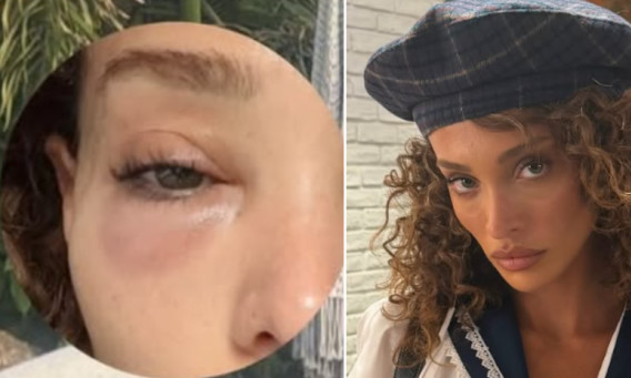 עדן פינס
