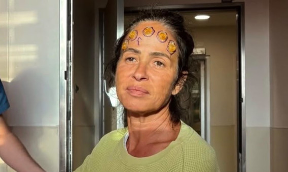 עינת ארליך