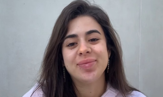 אנג'ל ברנס