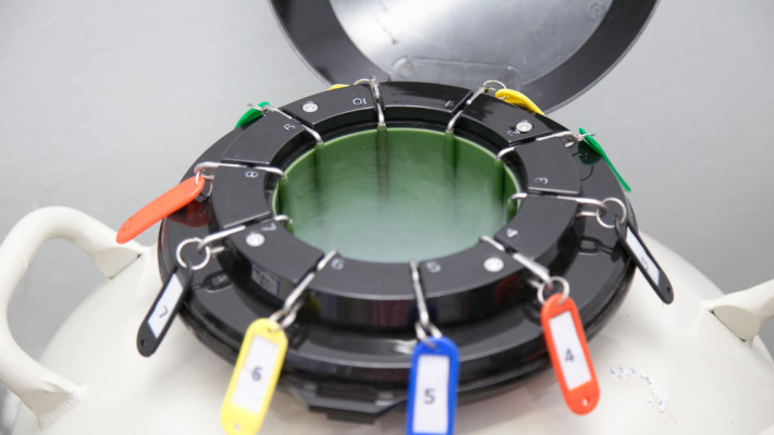 מיכל הקפאת ביציות. נשמר למשך שנים  (צילום: שאטרסטוק)