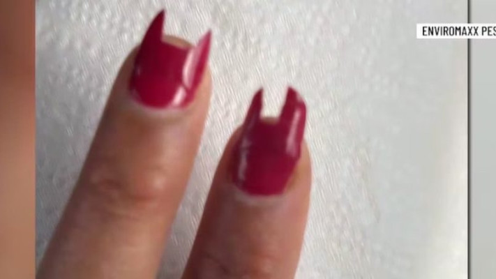 הציפורניים של האישה