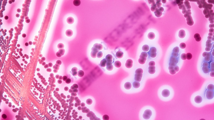 סטרפטוקוק. עלול לפלוש לאיברים פנימיים