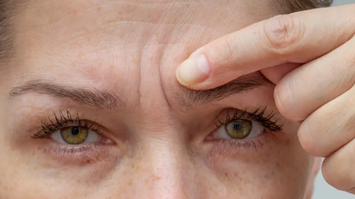 סימני הזדקנות