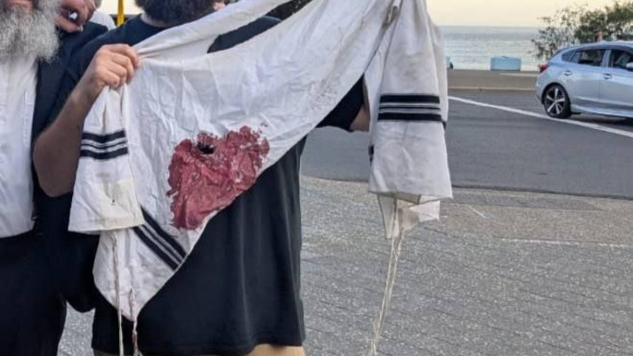 ציצית מוכתמת בדם באוסטרליה