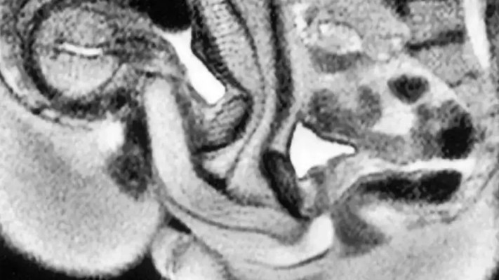 כן...זה מה שאתם חושבים. יחסי מין בתוך מכשיר MRI