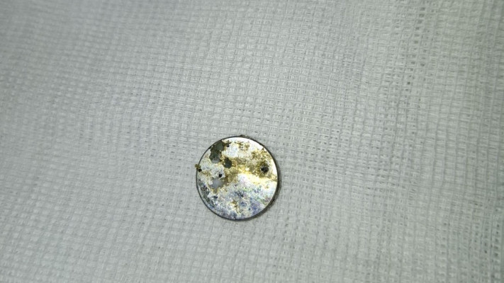 הסוללה לאחר שהוצאה